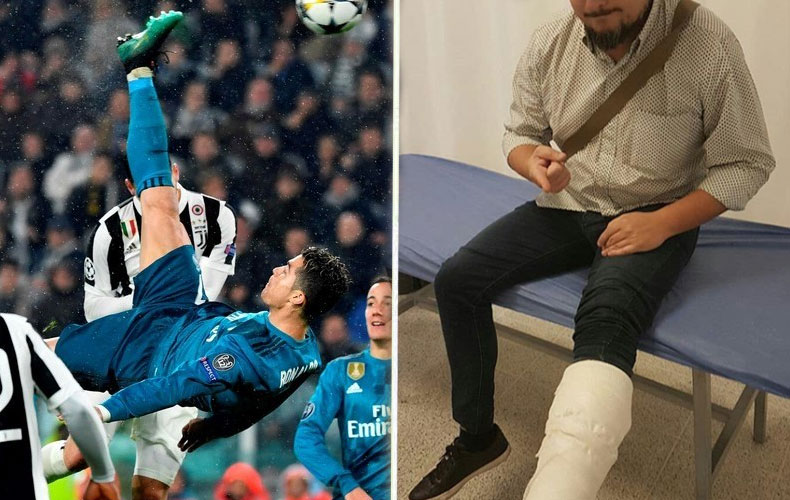 Intentó imitar la chilena de Cristiano Ronaldo…¡y terminó en el hospital! 